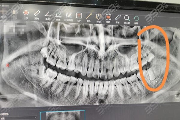 口腔科普小知识(图3)