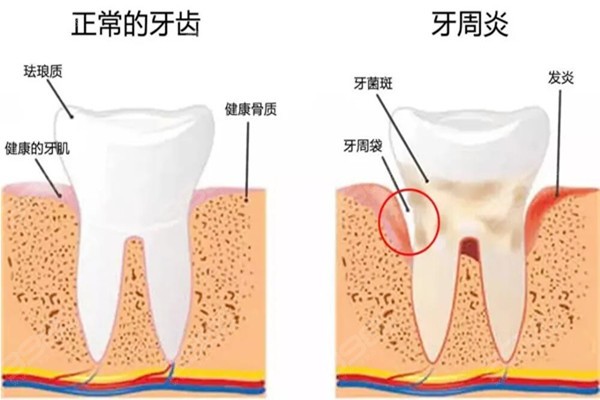 口腔科普小知识(图19)